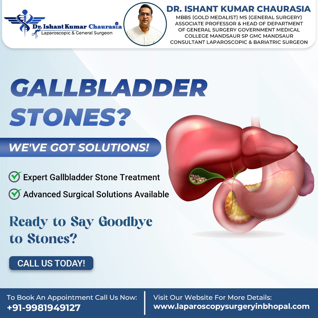 gallbladder stones treatment